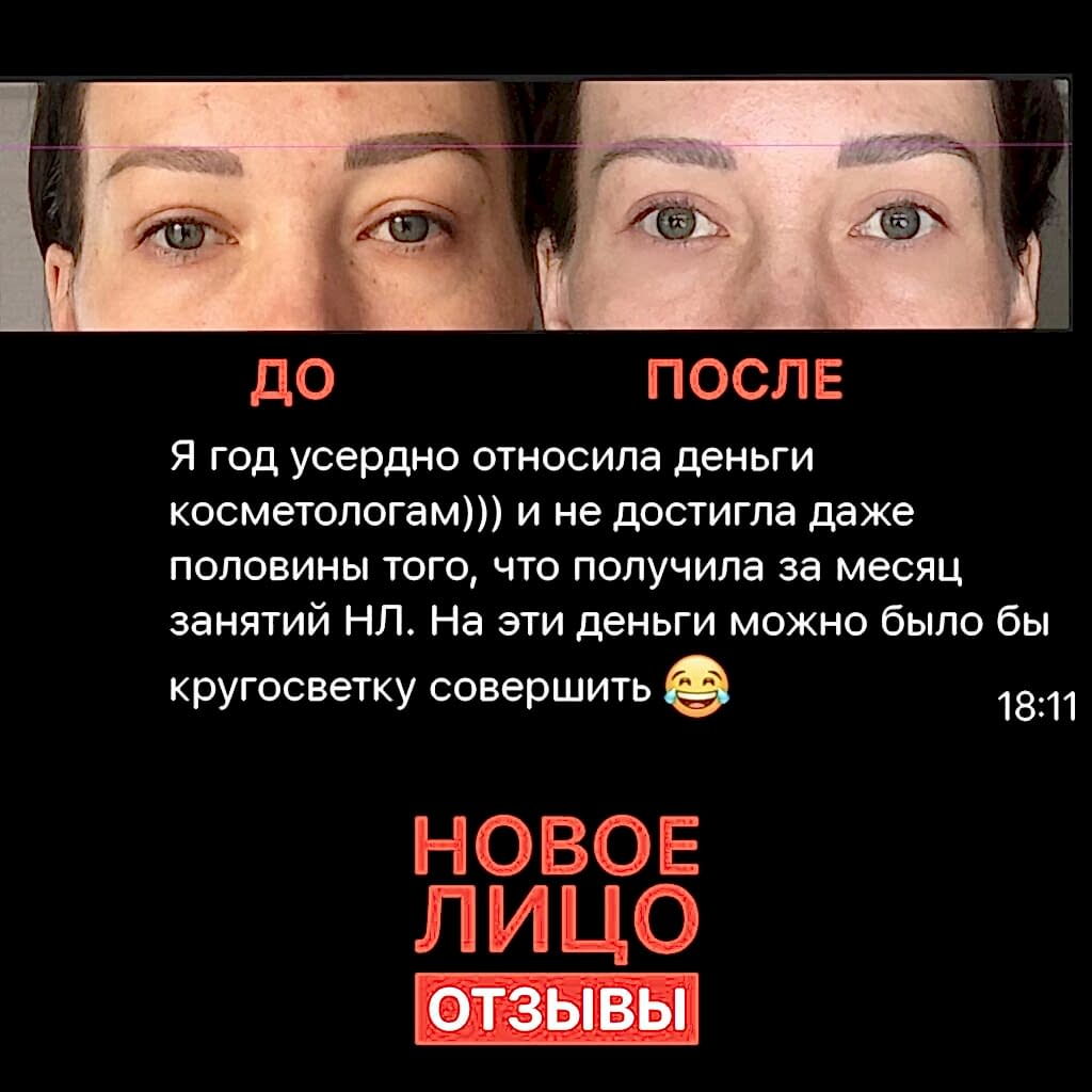 омоложение лица