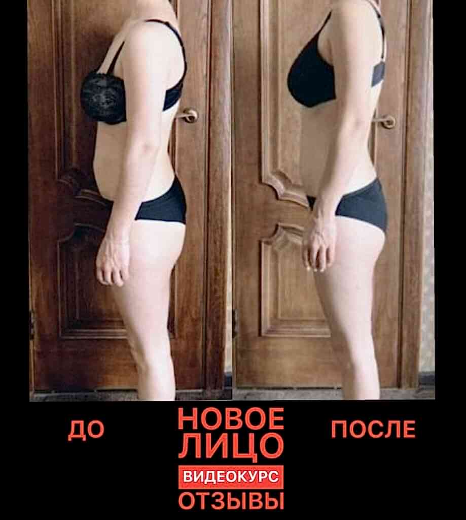 омоложение лица