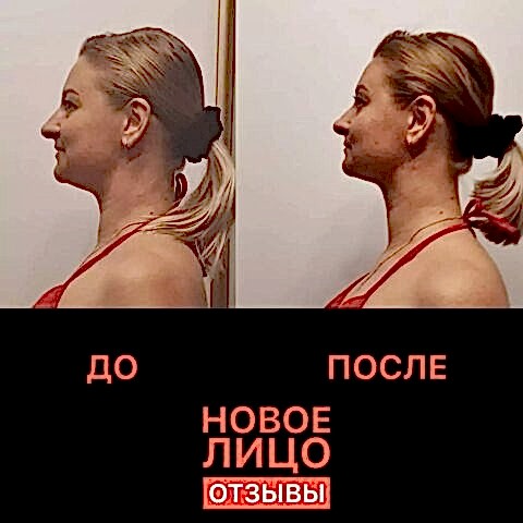 новое лицо омоложение алматы