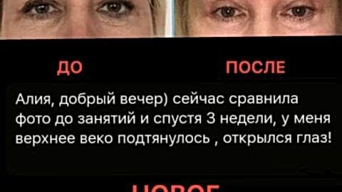 новое лицо отзывы естественное омоложение йога алматы
