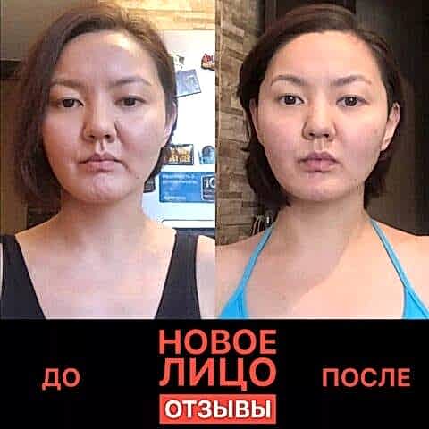 новое лицо отзывы естественное омоложение алматы