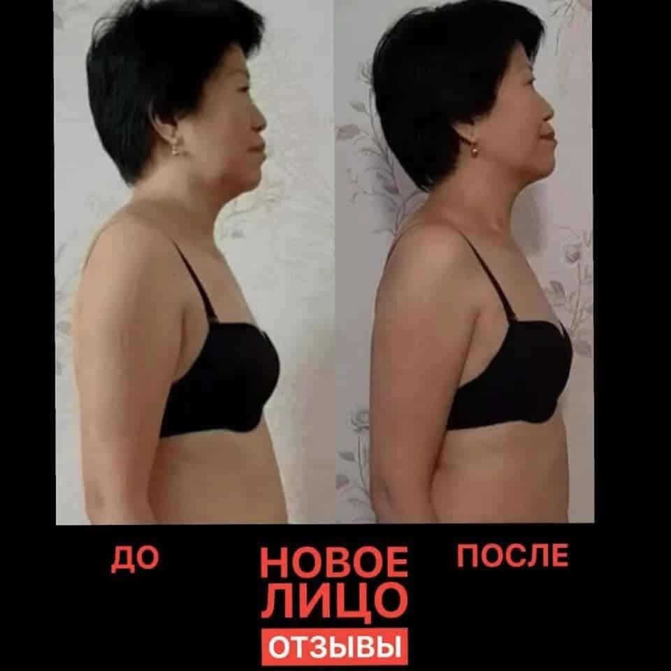 новое лицо алматы естественное омоложение