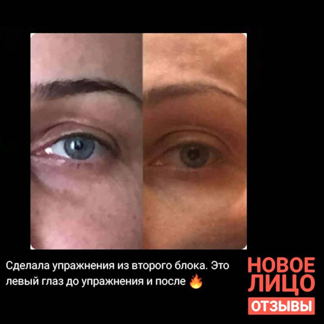 естественное омоложение алматы курс новое лицо