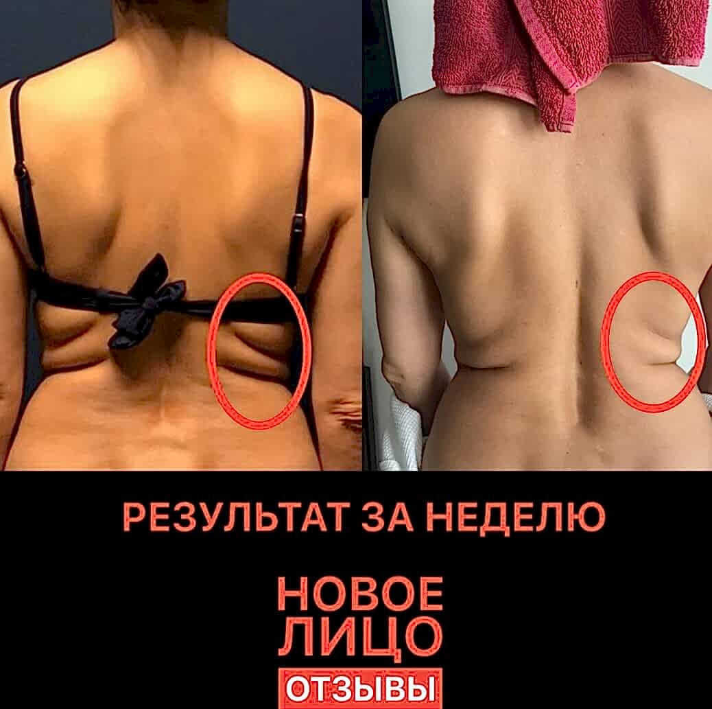 новое лицо естественное омоложение алия мусина
