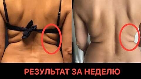 новое лицо естественное омоложение алия мусина