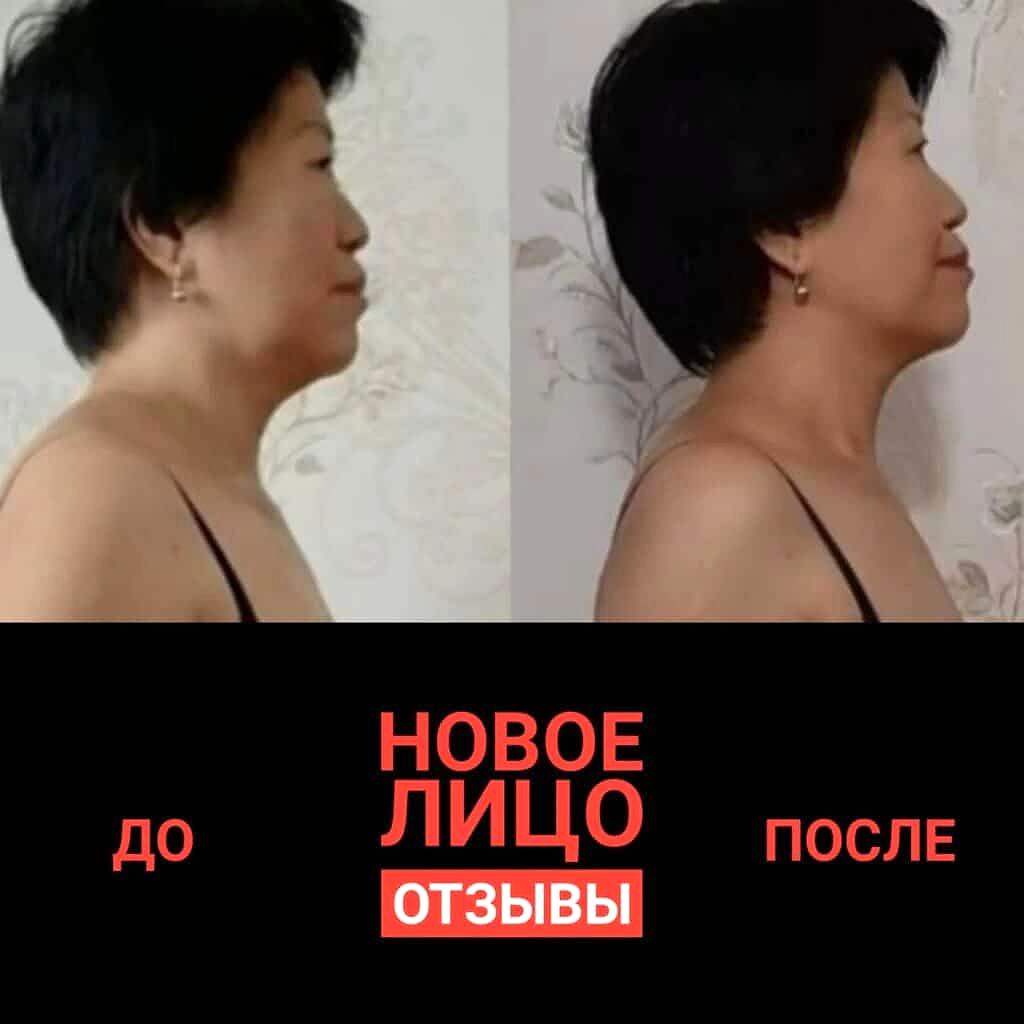 естественное омоложение курс новое лицо алматы алия мусина