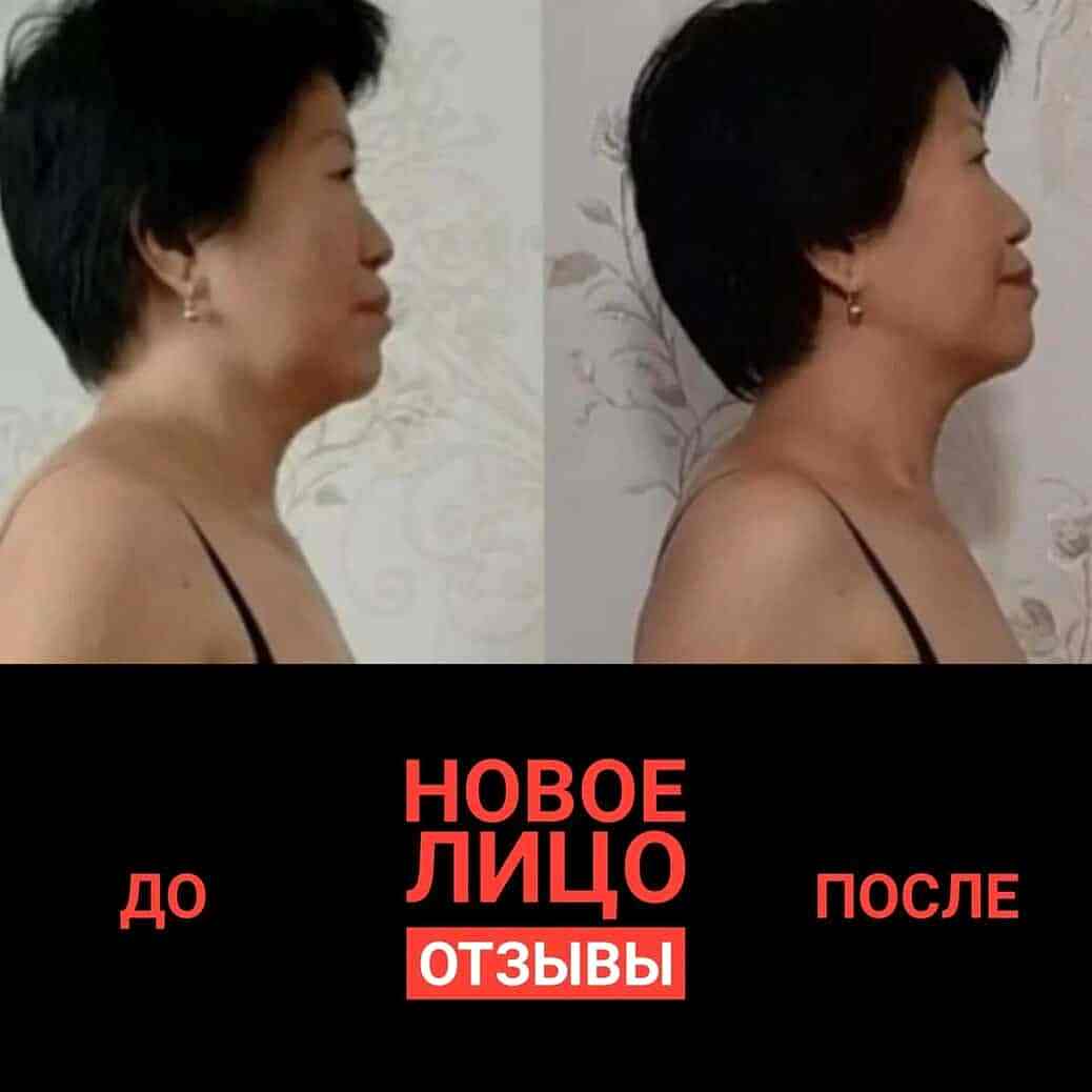 естественное омоложение курс новое лицо алматы алия мусина