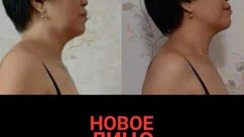 естественное омоложение курс новое лицо алматы алия мусина
