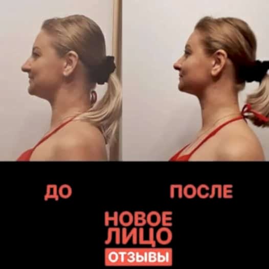 новое лицо естественное омоложение онлайн алия мусина антиэйдж