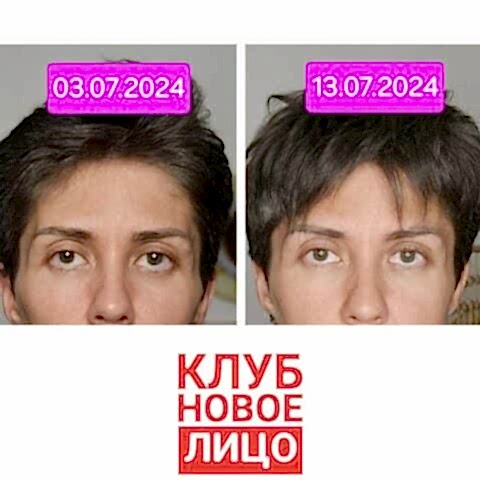 новое лицо онлайн клуб алия мусина естественное омоложение
