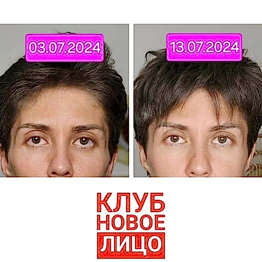 новое лицо онлайн клуб алия мусина естественное омоложение