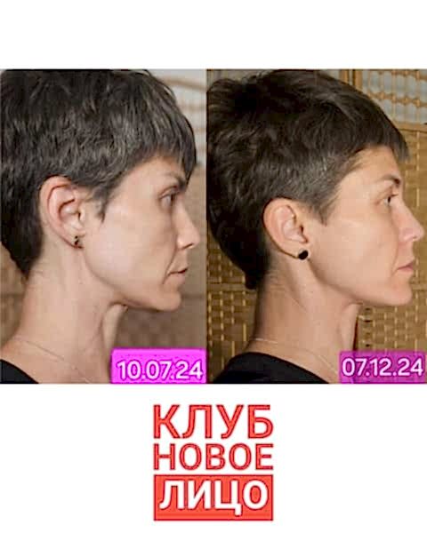 клуб новое лицо естественное омоложение алия мусина