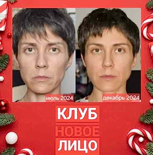 клуб новое лицо естественное омоложение тела алия мусина онлайн