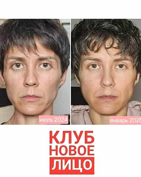 клуб новое лицо естественное омоложение алия мусина