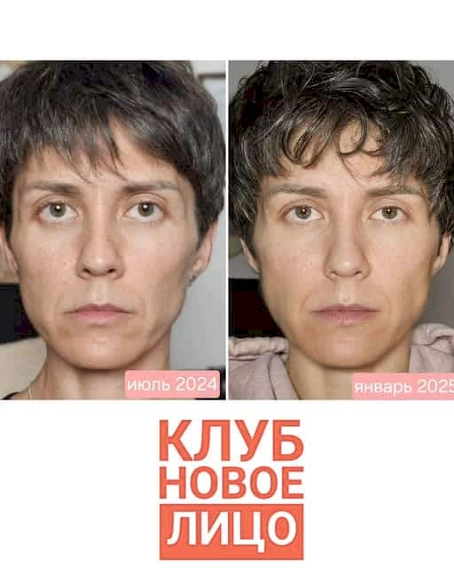 клуб новое лицо естественное омоложение алия мусина