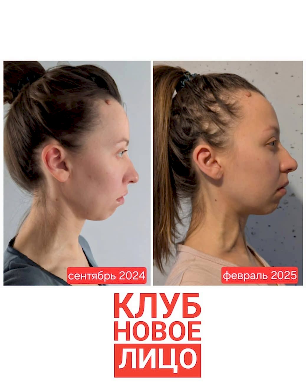 новое лицо естественное омоложение алия мусина
