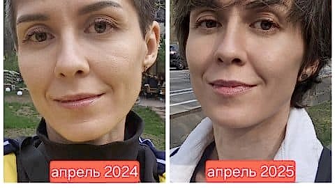 естественное омоложение клуб новое лицо алия мусина