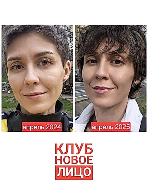естественное омоложение клуб новое лицо алия мусина